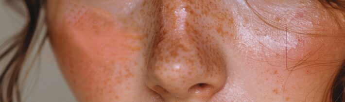 The Difference Between AHA and BHA Exfoliants